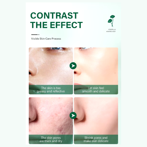 Transform Your Skin with the Power of Centella Asiatica: Visible Results You’ll Love